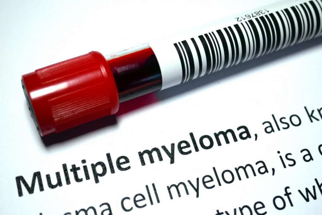 multiple myeloma